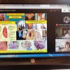 Відкрите лекційне заняття з теми «Патологічна фізіологія периферичного кровообігу»
